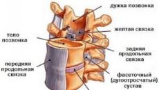 A gerincszalagok hipertrófiája Mit jelent a gerinc sárga szalagjainak hipertrófiája?