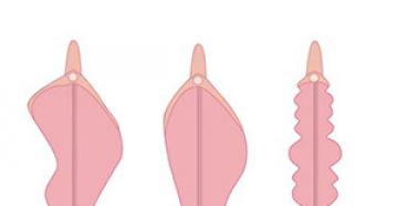 Le labbra nelle donne: struttura anatomica, indicazioni per la labioplastica