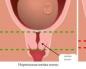 Struktura e trupit dhe e qafës së mitrës: madhësive dhe karakteristikave që e bëjnë qafën e mitrës