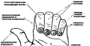 Choroby paznokci na nogach i rękach, zdjęcie, opis, objawy
